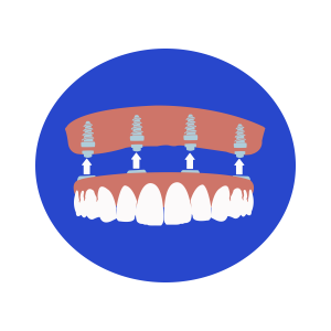 missing teeth