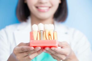 single tooth implant cost
