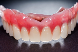 all on 4 dental | All On 4 Dental Implants Houston TX